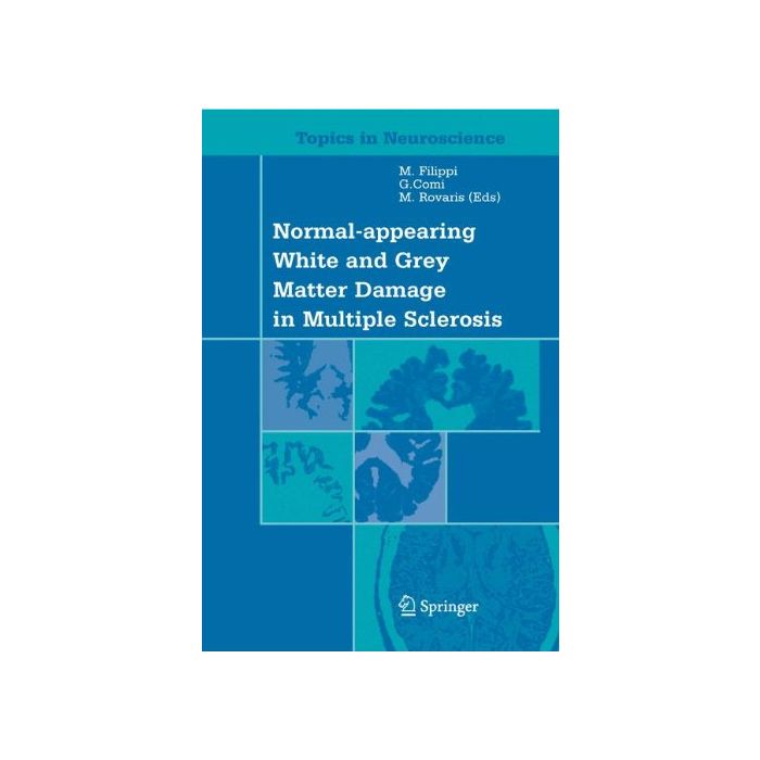 Normal Appearing White And Grey Matter Damage In Multiple Sclerosis - Filippi M. ; Comi G.  - Springer Verlag Italia - 9788847002432 Normal Appearing White And Grey Matter Damage In Multiple Sclerosis - Filippi M. ; Comi G.  - Springer Verlag Italia - 9788847002432