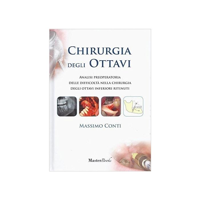 chirurgia-degli-ottavi-analisi-preoperatoria-delle-difficolta-nella-chirurgia-degli-ottavi-inferiori-ritenuti-conti-masterbooks-9788867610198 chirurgia-degli-ottavi-analisi-preoperatoria-delle-difficolta-nella-chirurgia-degli-ottavi-inferiori-ritenuti-conti-masterbooks-9788867610198