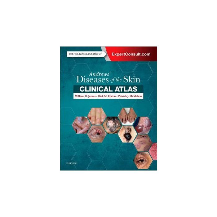 Andrews' Diseases of the Skin Clinical Atlas Andrews' Diseases of the Skin Clinical Atlas
