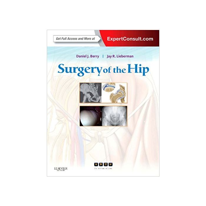 Surgery of the Hip - Expert Consult - Online and Print Berry Lieberman Elsevier Science Surgery of the Hip - Expert Consult - Online and Print Berry Lieberman Elsevier Science