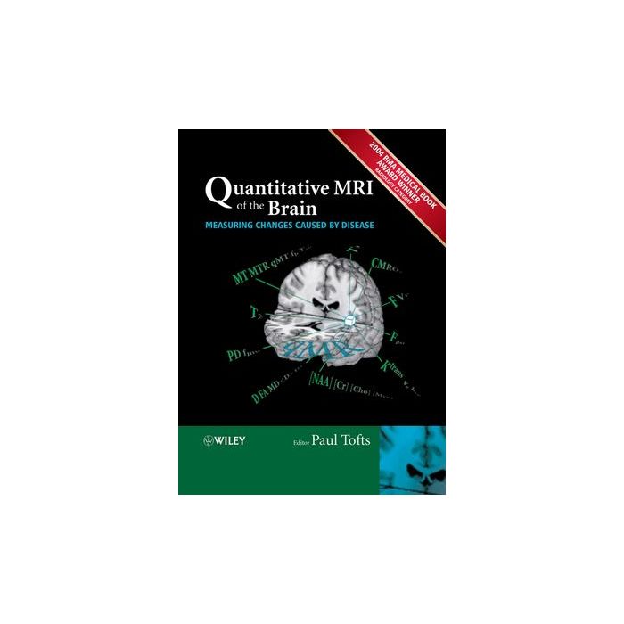 Quantitative MRI of the Brain: Measuring Changes Caused by Disease  Tofts Paul  Wiley - Blackwell  9780470014295