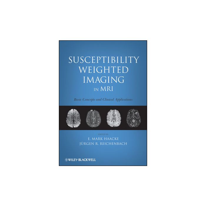 Susceptibility Weighted Imaging in MRI: Basic Concepts and Clinical Applications  Haacke E. Mark; Reichenbach Jurgen R.  Wiley - Blackwell  9780470043431 Susceptibility Weighted Imaging in MRI: Basic Concepts and Clinical Applications  Haacke E. Mark; Reichenbach Jurgen R.  Wiley - Blackwell  9780470043431