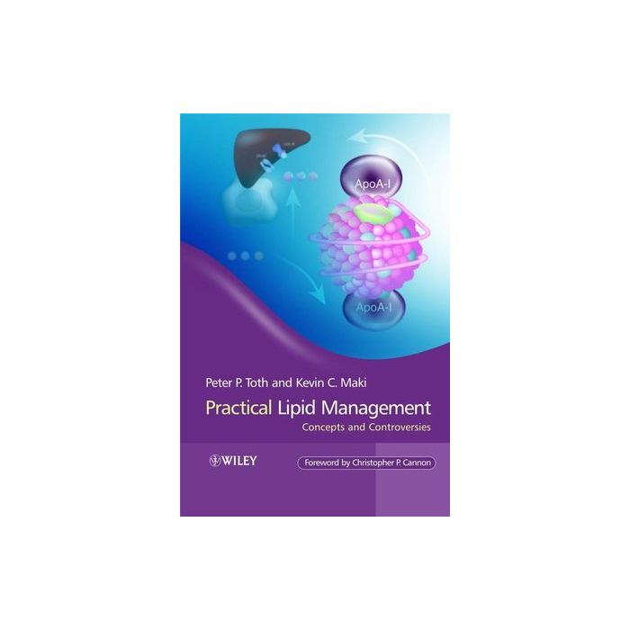 Practical Lipid Management: Concepts and Controversies Toth Peter P.; Maki Kevin Wiley - Blackwell 9780470056905 Practical Lipid Management: Concepts and Controversies Toth Peter P.; Maki Kevin Wiley - Blackwell 9780470056905