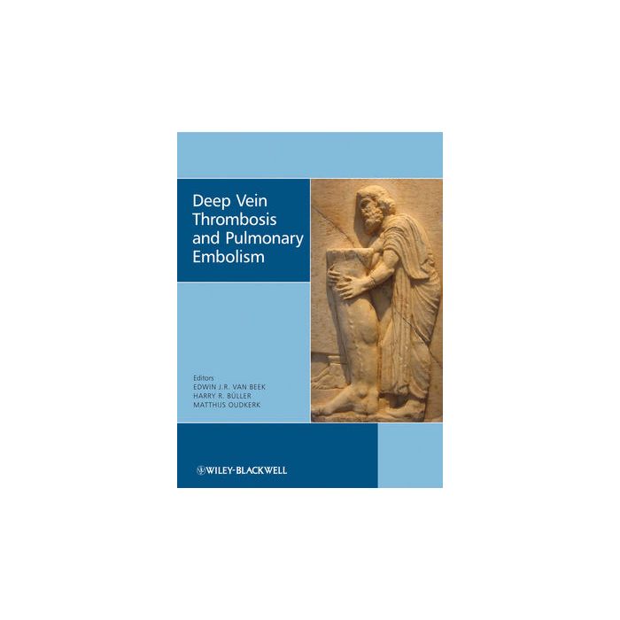 Deep Vein Thrombosis and Pulmonary Embolism Van Beek Edwin J. R.; Büller Harry R.; Oudkerk Mathijs Wiley - Blackwell 9780470517178 Deep Vein Thrombosis and Pulmonary Embolism Van Beek Edwin J. R.; Büller Harry R.; Oudkerk Mathijs Wiley - Blackwell 9780470517178