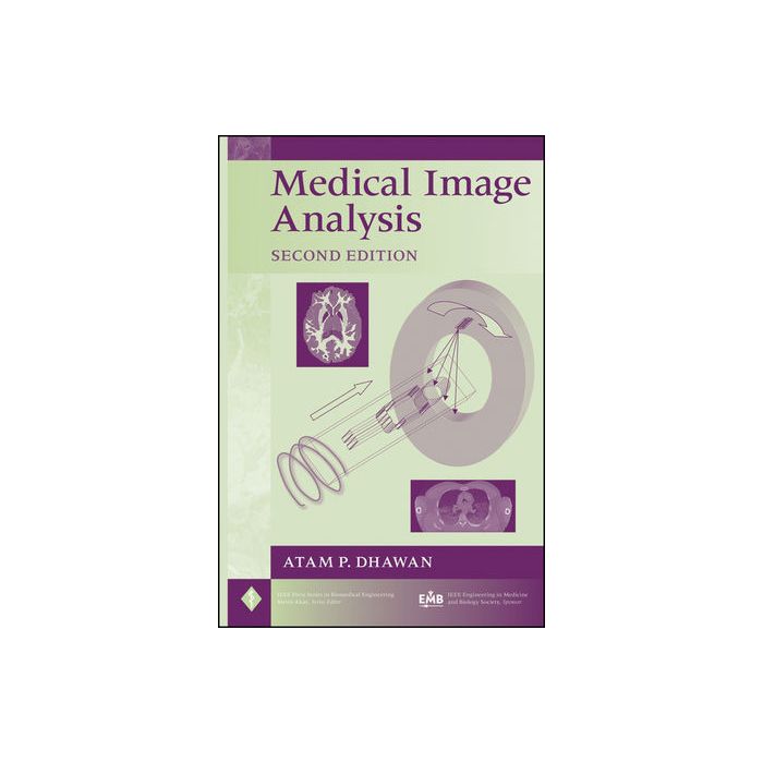 Medical Image Analysis, 2ed.  Dhawan Atam P.  Wiley - Blackwell  9780470622056