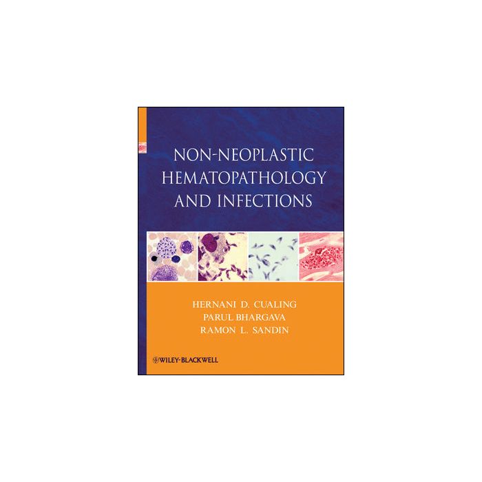 Non-Neoplastic Hematopathology and Infections Cualing Hernani; Bhargava Parul; Sandin Ramon L. Wiley - Blackwell 9780470646007 Non-Neoplastic Hematopathology and Infections Cualing Hernani; Bhargava Parul; Sandin Ramon L. Wiley - Blackwell 9780470646007