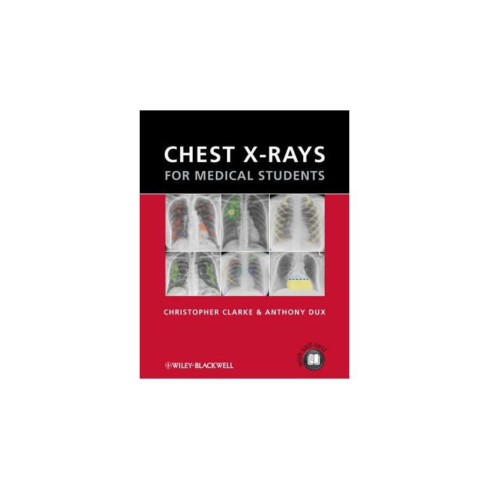 Chest X-rays for Medical Students  Clarke Christopher; Dux Anthony  Wiley - Blackwell  9780470656198