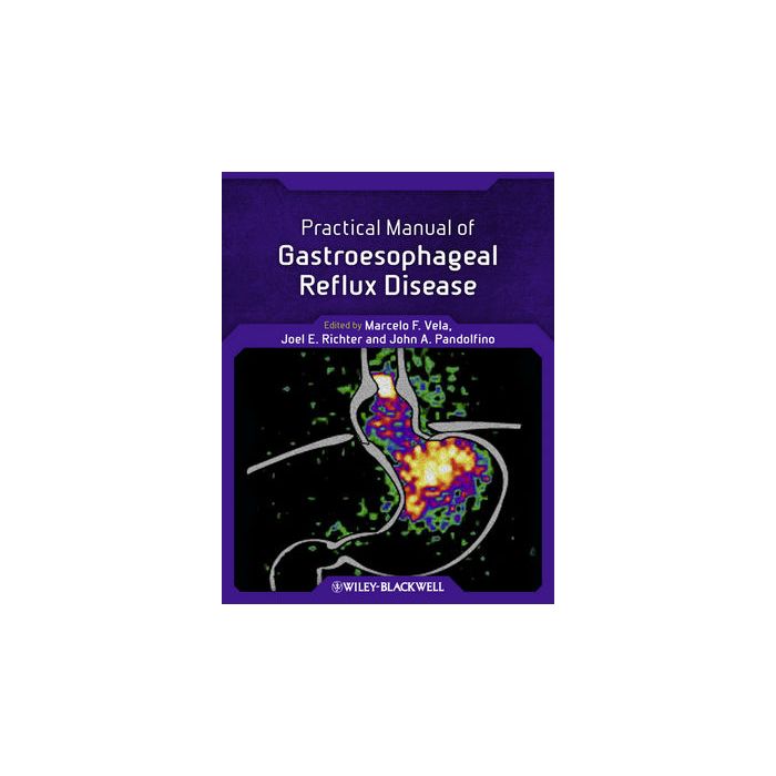 Practical Manual of Gastroesophageal Reflux Disease  Vela Marcelo F.; Richter Joel E.; Pandolfino John E.  Wiley - Blackwell  9780470656266