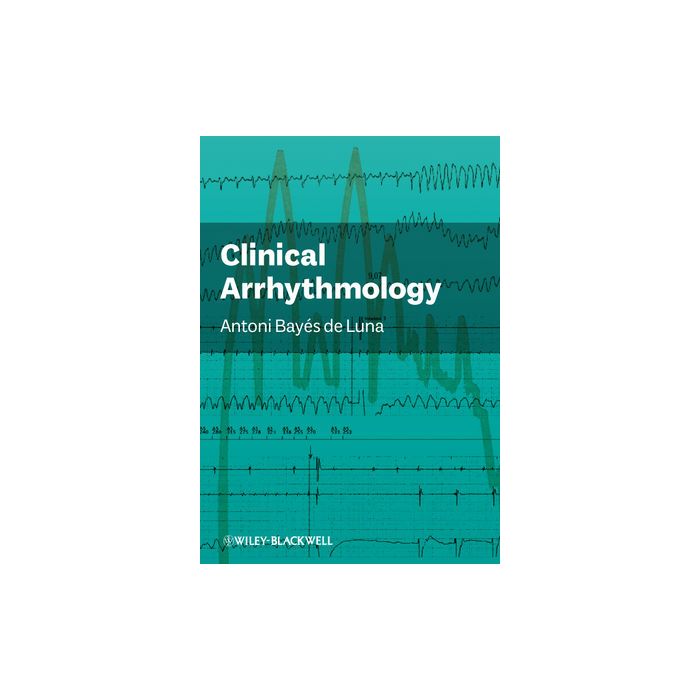 Clinical Arrhythmology  Bayes de Luna Antoni  Wiley - Blackwell  9780470656365