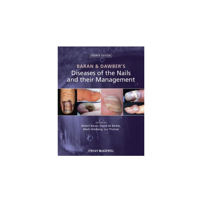 Baran and Dawber's Diseases of the Nails and their Management, 4ed. Baran Robert; de Berker David A. R.; Holzberg Mark; Thomas Luc Wiley - Blackwell 9780470657355 Baran and Dawber's Diseases of the Nails and their Management, 4ed. Baran Robert; de Berker David A. R.; Holzberg Mark; Thomas Luc Wiley - Blackwell 9780470657355
