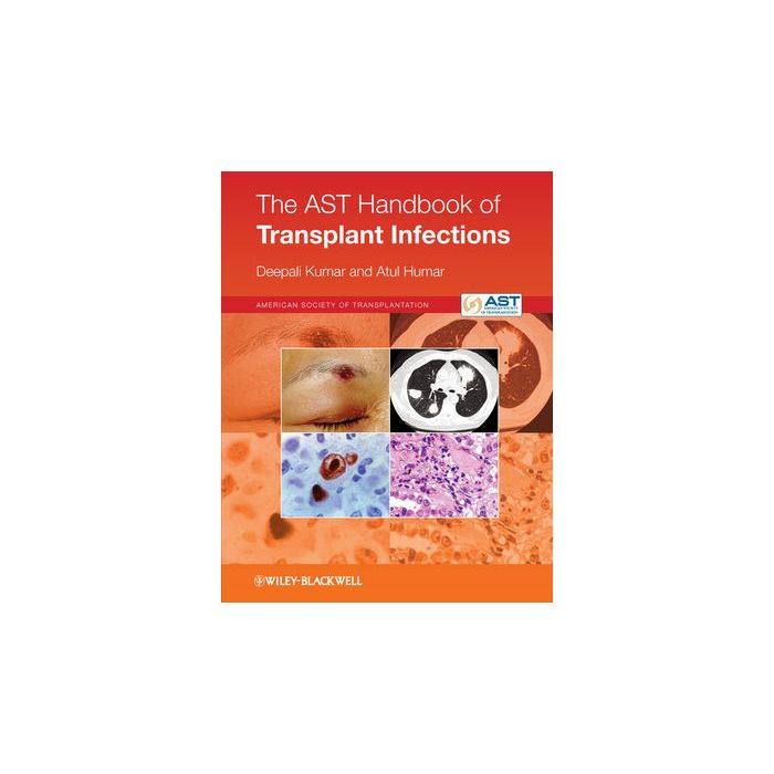 The AST Handbook of Transplant Infections  Kumar Deepali; Humar Atul  Wiley - Blackwell  9780470658277