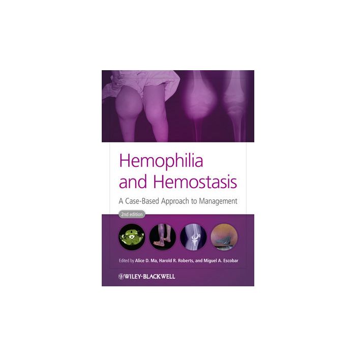 Hemophilia and Hemostasis: A Case-Based Approach to Management, 2ed.  Ma Alice D.; Roberts Harold R.; Escobar Miguel A.  Wiley - Blackwell  9780470659762