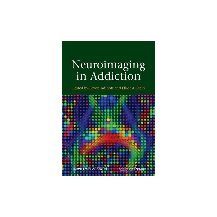 Neuroimaging in Addiction Adinoff Bryon; Stein Elliot A. Wiley - Blackwell 9780470660140 Neuroimaging in Addiction Adinoff Bryon; Stein Elliot A. Wiley - Blackwell 9780470660140