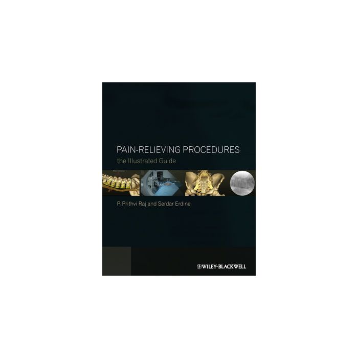 Pain-Relieving Procedures: The Illustrated Guide  Raj P. Prithvi; Erdine Serdar  Wiley - Blackwell  9780470670385