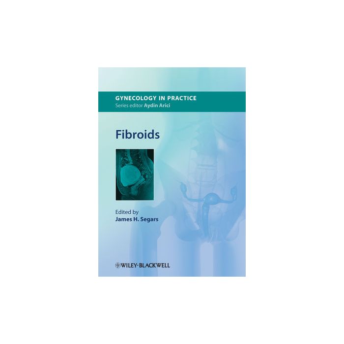 Fibroids  Segars James H.  Wiley - Blackwell  9780470670941