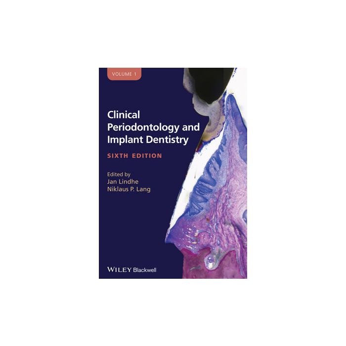 Clinical Periodontology and Implant Dentistry, 2 Volume Set, 6ed.  Lang Niklaus P.; Lindhe Jan  Wiley - Blackwell  9780470672488 Clinical Periodontology and Implant Dentistry, 2 Volume Set, 6ed.  Lang Niklaus P.; Lindhe Jan  Wiley - Blackwell  9780470672488