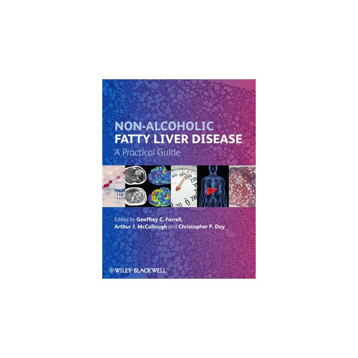 Non-Alcoholic Fatty Liver Disease: A Practical Guide  Farrell Geoffrey C.; McCullough Arthur J.; Day Christopher P.  Wiley - Blackwell  9780470673171