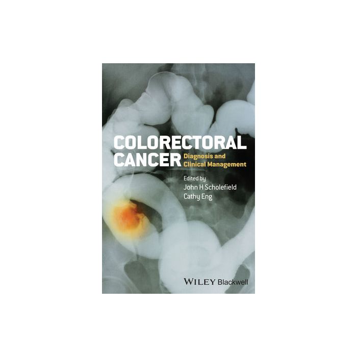 Colorectal Cancer: Diagnosis and Clinical Management  Scholefield John; Eng Cathy  Wiley - Blackwell  9780470674802