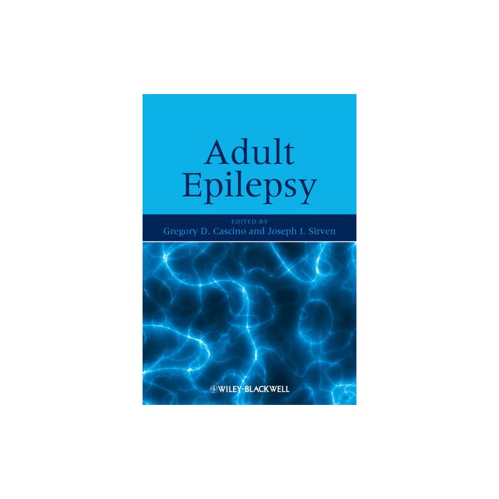 Adult Epilepsy Cascino Gregory; Sirven Joseph Wiley-Blackwell 9780470741221 Adult Epilepsy Cascino Gregory; Sirven Joseph Wiley-Blackwell 9780470741221