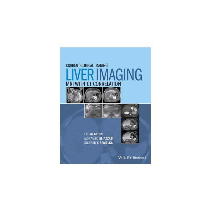 Liver Imaging: MRI with CT Correlation  Altun Ersan; El-Azzazi Mohamed; Semelka Richard C.  Wiley - Blackwell  9780470906255