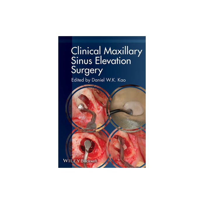 Clinical Maxillary Sinus Elevation Surgery Kao Daniel W. K. Wiley - Blackwell 9780470960738 Clinical Maxillary Sinus Elevation Surgery Kao Daniel W. K. Wiley - Blackwell 9780470960738