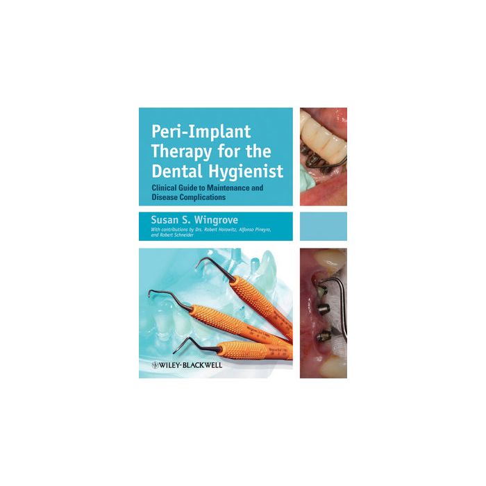 Peri-Implant Therapy for the Dental Hygienist: Clinical Guide to Maintenance and Disease Complications  Wingrove Susan S.  Wiley - Blackwell  9780470962855