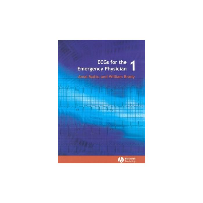 ECGs for the Emergency Physician 1 Mattu Amal; Brady William J. Wiley - Blackwell 9780727916549 ECGs for the Emergency Physician 1 Mattu Amal; Brady William J. Wiley - Blackwell 9780727916549