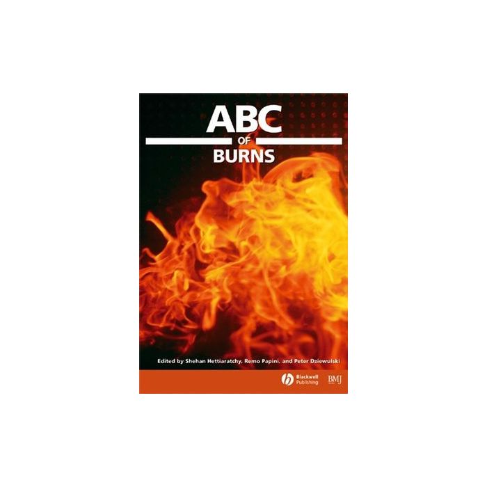 ABC of Burns  Hettiaratchy Shehan; Papini Remo; Dziewulski Peter  Wiley - Blackwell  9780727917874