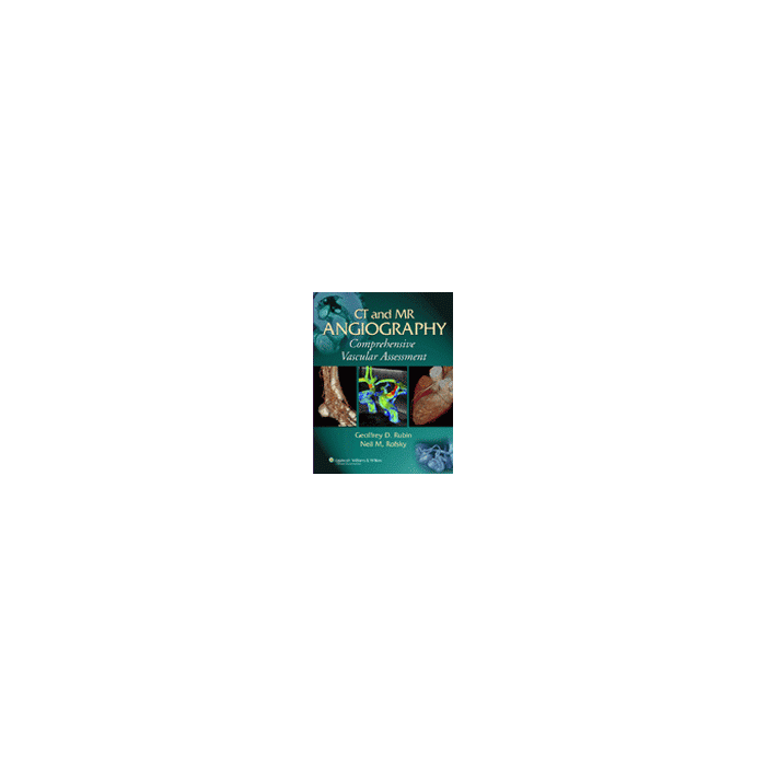CT and MR Angiography  Rubin Geoffrey D.; Rofsky Neil M.  LIPPINCOTT Williams and Wilkins  9780781745253