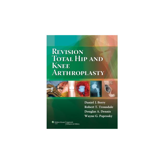 Revision Total Hip and Knee Arthroplasty Berry Daniel J.; Trousdale Robert T; Dennis Douglas A.; Paprosky Wayne G. LIPPINCOTT Williams and Wilkins 9780781760430 Revision Total Hip and Knee Arthroplasty Berry Daniel J.; Trousdale Robert T; Dennis Douglas A.; Paprosky Wayne G. LIPPINCOTT Williams and Wilkins 9780781760430