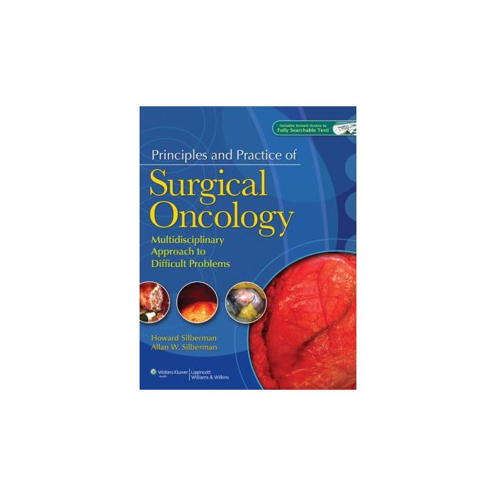 Principles and Practice of Surgical Oncology Silberman Howard; Silberman Allan W. LIPPINCOTT Williams and Wilkins 9780781765466 Principles and Practice of Surgical Oncology Silberman Howard; Silberman Allan W. LIPPINCOTT Williams and Wilkins 9780781765466
