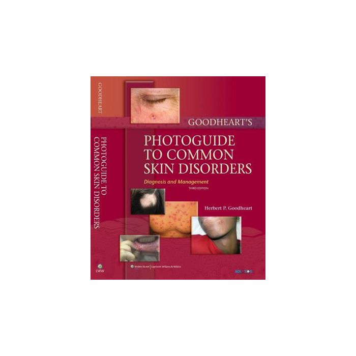 Goodheart's Photoguide to Common Skin Disorders, 3ed.  Goodheart Herbert P.  LIPPINCOTT Williams and Wilkins  9780781771436 Goodheart's Photoguide to Common Skin Disorders, 3ed.  Goodheart Herbert P.  LIPPINCOTT Williams and Wilkins  9780781771436