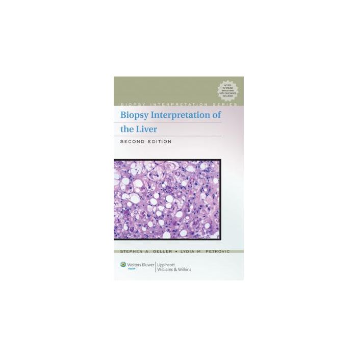 Biopsy Interpretation of the Liver, 2ed.  Geller Stephen A.; Petrovic Lydia M.  LIPPINCOTT Williams and Wilkins  9780781774680