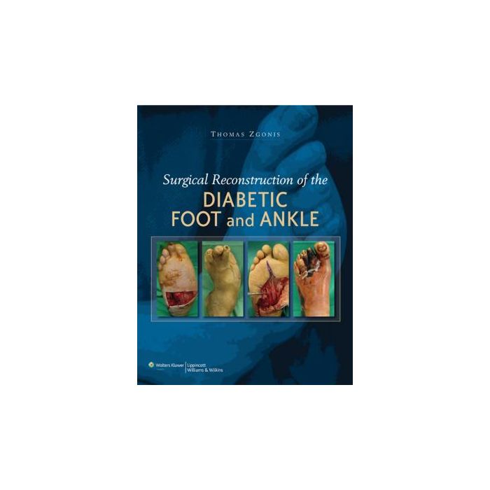 Surgical Reconstruction of the Diabetic Foot and Ankle Zgonis Thomas LIPPINCOTT Williams and Wilkins 9780781784580 Surgical Reconstruction of the Diabetic Foot and Ankle Zgonis Thomas LIPPINCOTT Williams and Wilkins 9780781784580