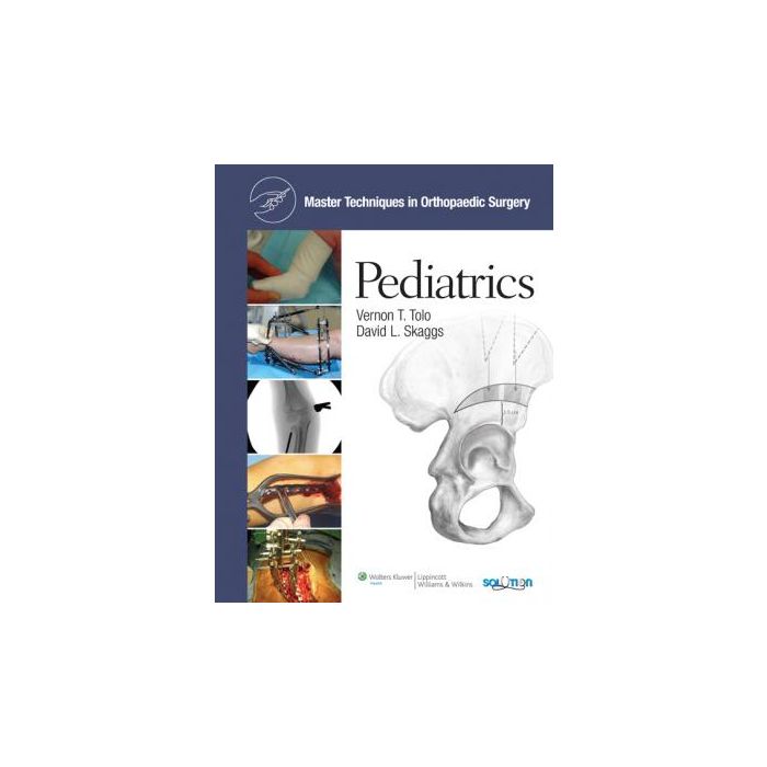 Master Techniques in Orthopaedic Surgery: Pediatrics Tolo Vernon T.; Skaggs David L. LIPPINCOTT Williams and Wilkins 9780781791243 Master Techniques in Orthopaedic Surgery: Pediatrics Tolo Vernon T.; Skaggs David L. LIPPINCOTT Williams and Wilkins 9780781791243