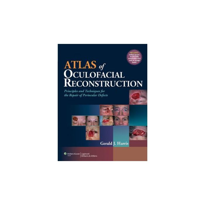 Atlas of Oculofacial Reconstruction  Harris Gerald J.  LIPPINCOTT Williams and Wilkins  9780781796514