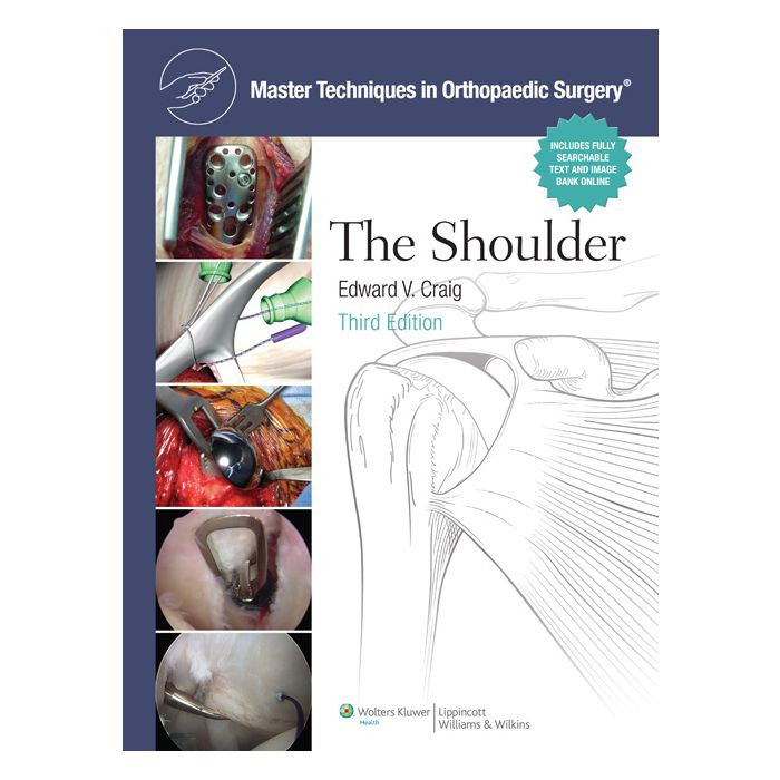 The Master Techniques in Orthopaedic Surgery: Shoulder, 3ed.  Craig Edward V.  LIPPINCOTT Williams and Wilkins  9780781797481