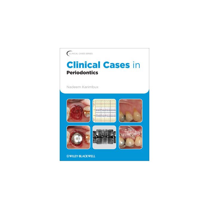 Clinical Cases in Periodontics  Karimbux Nadeem  Wiley - Blackwell  9780813807942