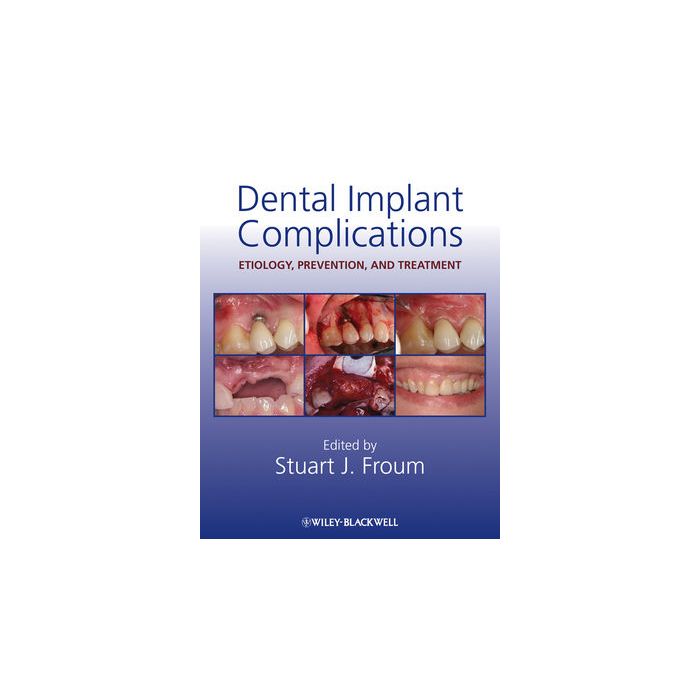 Dental Implant Complications: Etiology, Prevention, and Treatment  Froum Stuart J.  Wiley - Blackwell  9780813808413