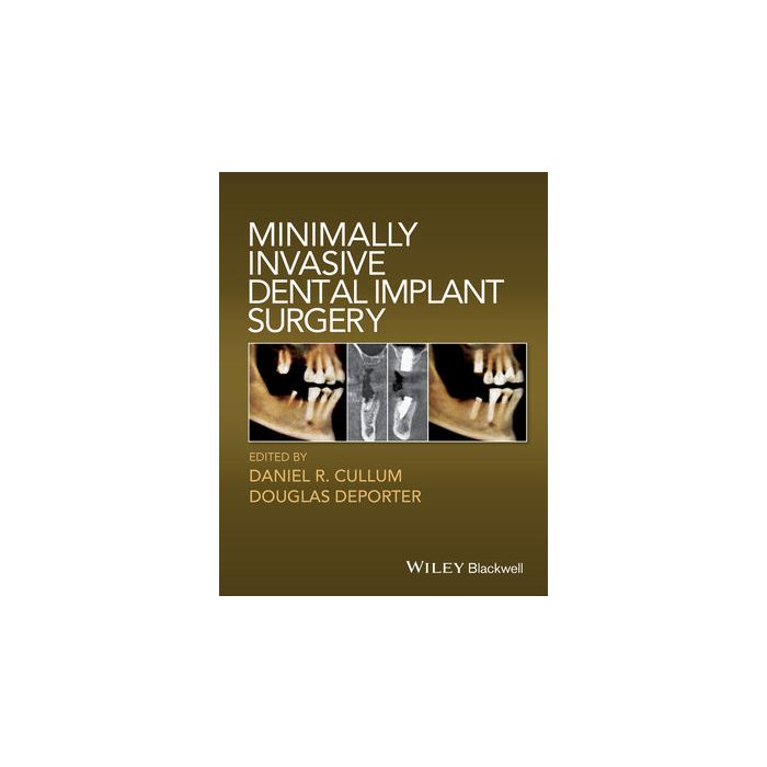 Minimally Invasive Dental Implant Surgery  Cullum Daniel R.; Depoter Douglas  Wiley - Blackwell  9780813814520