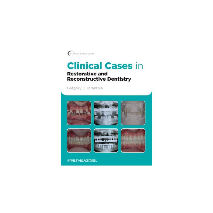 Clinical Cases in Restorative and Reconstructive Dentistry  Tarantola Gregory J.  Wiley - Blackwell  9780813815640