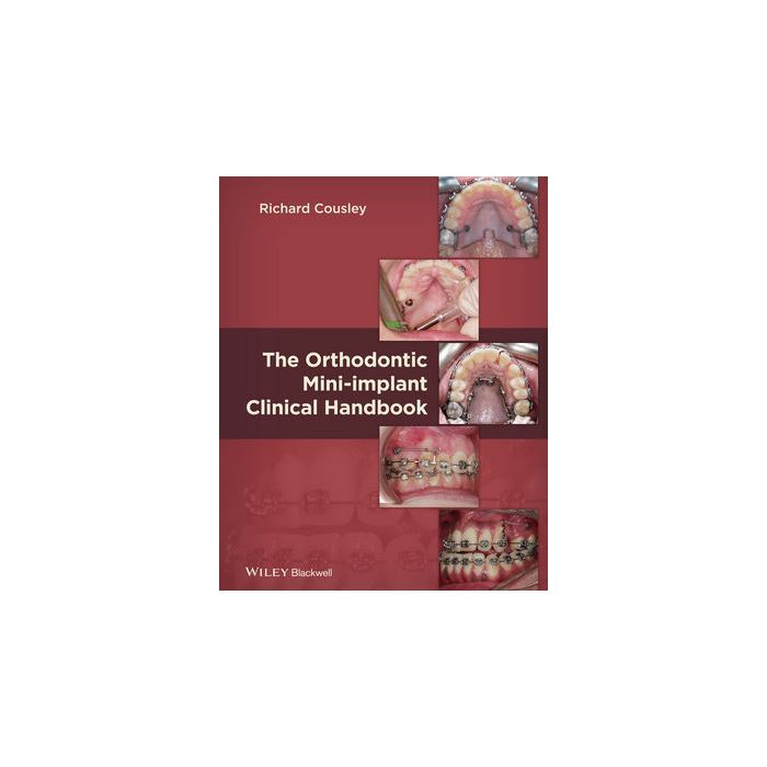 The Orthodontic Mini-implant Clinical Handbook  Cousley Richard  Wiley - Blackwell  9781118275993