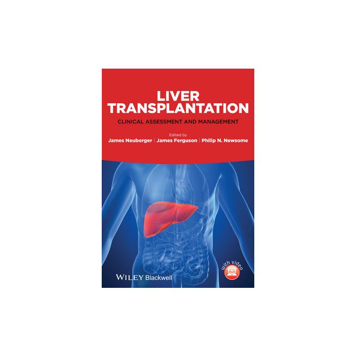 Liver Transplantation: Clinical Assessment and Management  Neuberger James; Ferguson James; Newsome Philip N.  Wiley - Blackwell  9781118277386