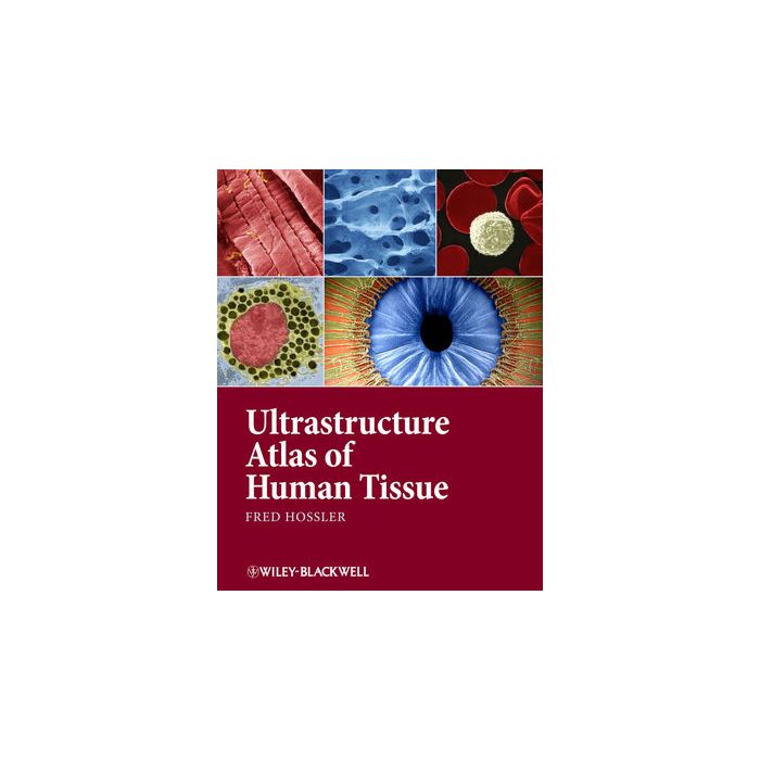 Ultrastructure Atlas of Human Tissues Hossler Fred Wiley - Blackwell 9781118284537 Ultrastructure Atlas of Human Tissues Hossler Fred Wiley - Blackwell 9781118284537