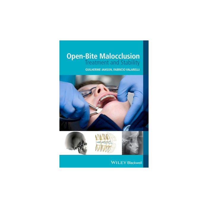 Open-Bite Malocclusion: Treatment and Stability  Janson Guilherme; Valarelli Fabricio  Wiley - Blackwell  9781118335987