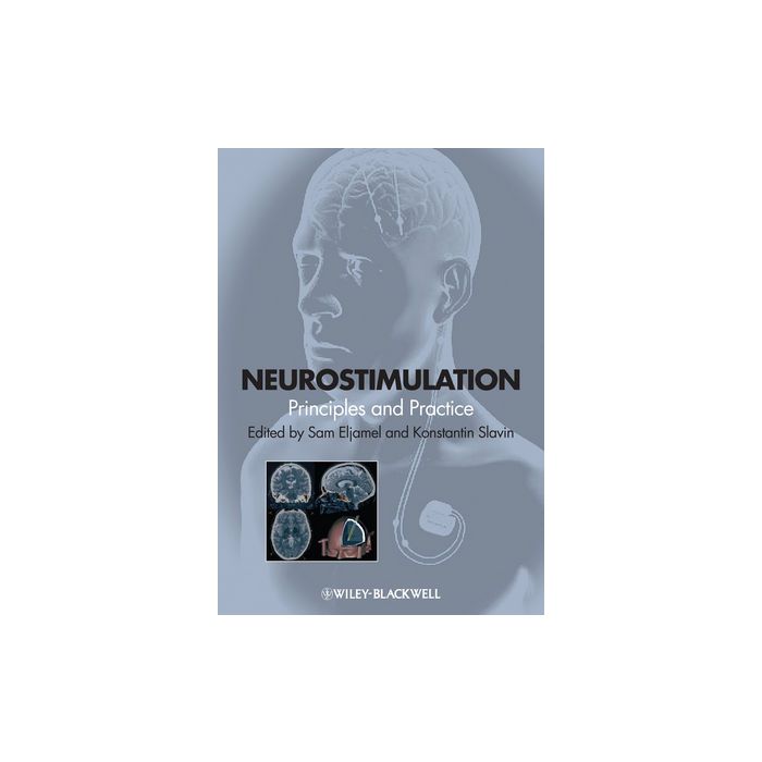 Neurostimulation: Principles and Practice Eljamel Sam; Slavin Konstantin Wiley-Blackwell 9781118346358 Neurostimulation: Principles and Practice Eljamel Sam; Slavin Konstantin Wiley-Blackwell 9781118346358