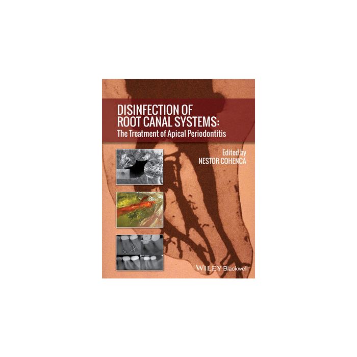 Disinfection of Root Canal Systems: The Treatment of Apical Periodontitis  Cohenca Nestor  Wiley - Blackwell  9781118367681