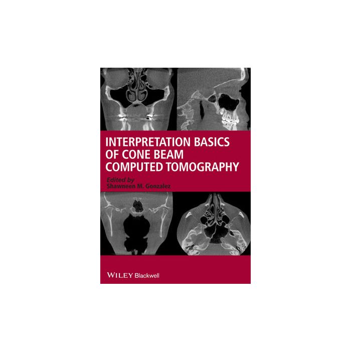 Interpretation Basics of Cone Beam Computed Tomography  Gonzalez Shawneen M.  Wiley - Blackwell  9781118381069