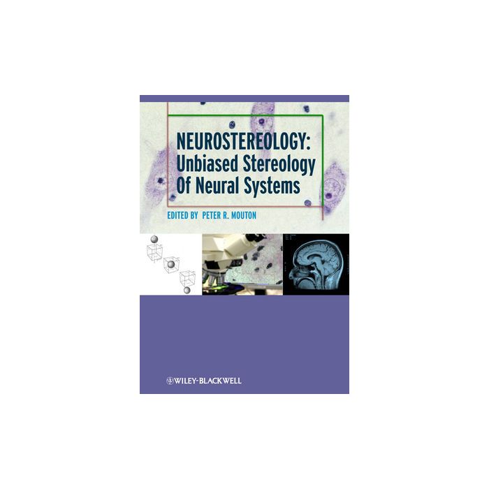 Neurostereology: Unbiased Stereology of Neural Systems Mouton Peter R. Wiley - Blackwell 9781118444214 Neurostereology: Unbiased Stereology of Neural Systems Mouton Peter R. Wiley - Blackwell 9781118444214