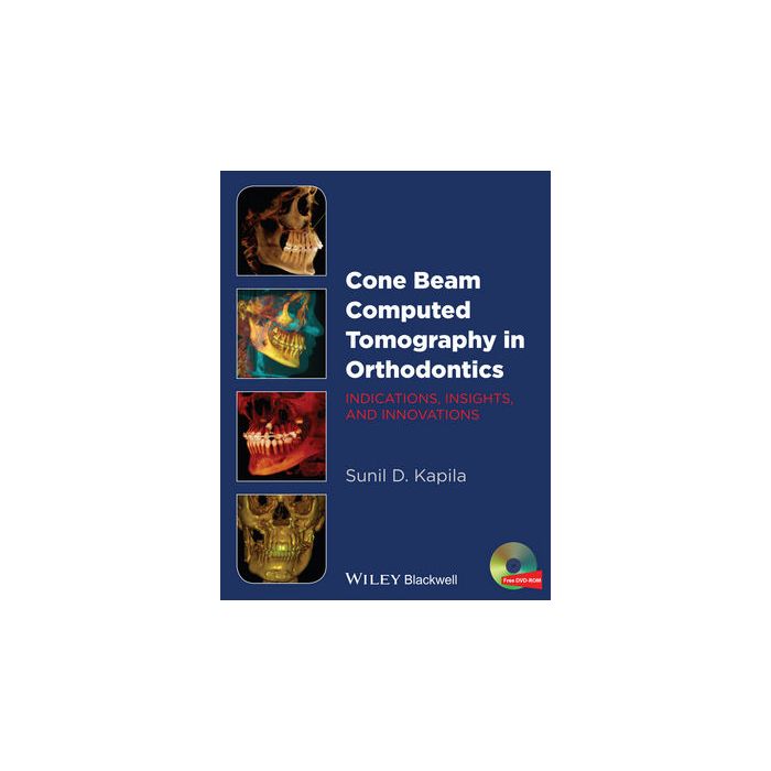 Cone Beam Computed Tomography in Orthodontics: Indications, Insights, and Innovations Kapila Sunil Wiley - Blackwell 9781118448489 Cone Beam Computed Tomography in Orthodontics: Indications, Insights, and Innovations Kapila Sunil Wiley - Blackwell 9781118448489